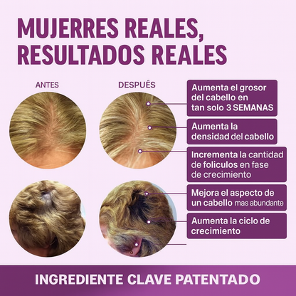 Gomitas Crecimiento Capilar Hair Growth